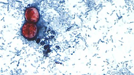 FILE PHOTO. Two cyclospora cayetanensis oocysts (L) in a fresh tool sample.